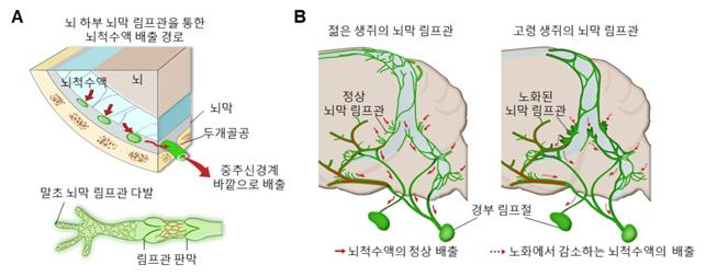 치매.jpg