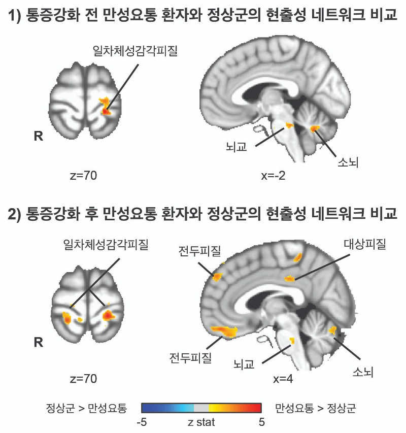 요통1.jpg