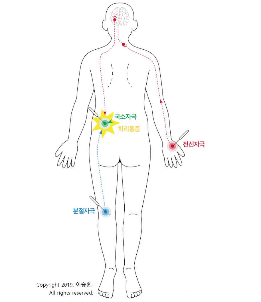 이승훈1.jpg