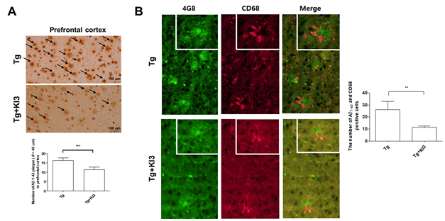 [이미지자료4] 태계혈 전기침 자극으로 알츠하이머 동물의 베타 아밀로이드와 미세아교세포 감소.png