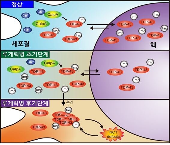 뇌질환2.png