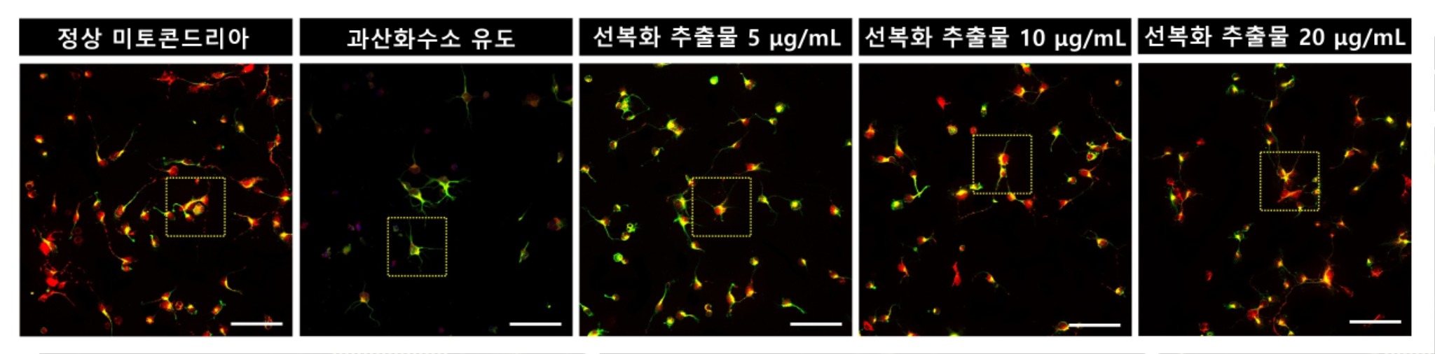 [사진설명] 과산화수소로 유도된 산화스트레스 환경에서는 미토콘드리아(붉은색)가 크게 감소했고 선복화 처리군에서는 농도가 진해질수록 미토콘드리아의 발현이 크게 증가해 정상 수준에 가깝게 회복됐고 미토콘드리아 모양도 정상과 같이 길쭉한 타원형으로 관찰됐다.jpg