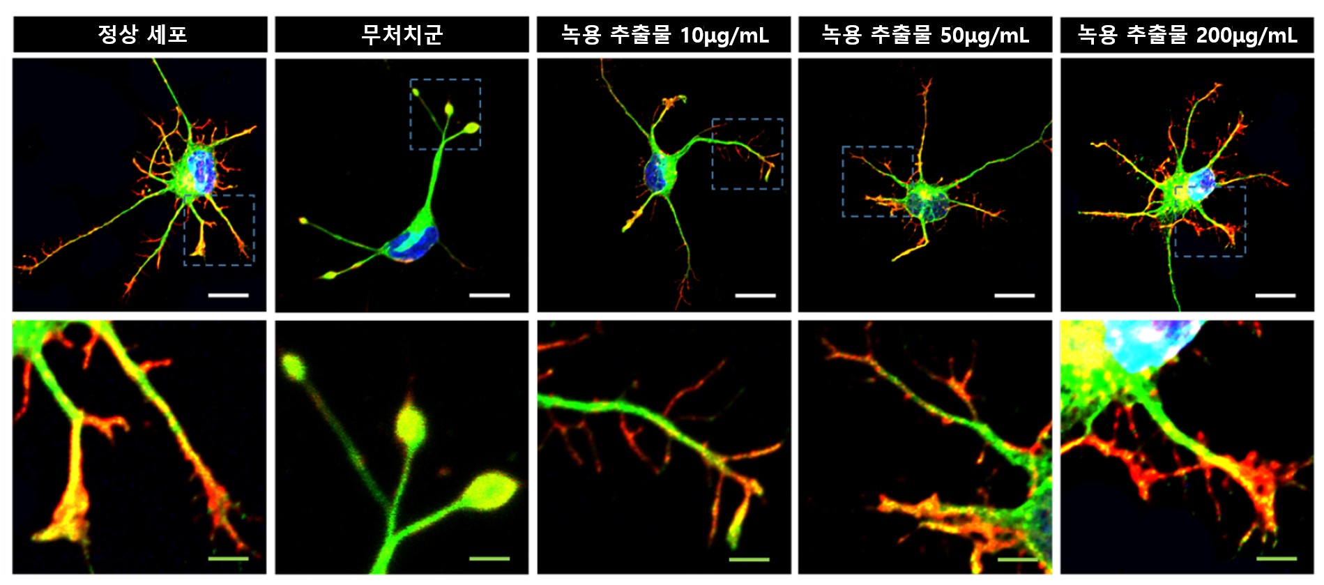 [사진설명] 고배율 현미경 관찰 상 과산화수소 처리돼 손상을 유도한 신경세포에서는 타원 모양의 수축전구가 발견됐지만 녹용 추출물을 처리한 신경세포에서는 농도에 따라 재생이 유도돼 축삭돌기가 회복 증가했다..jpg