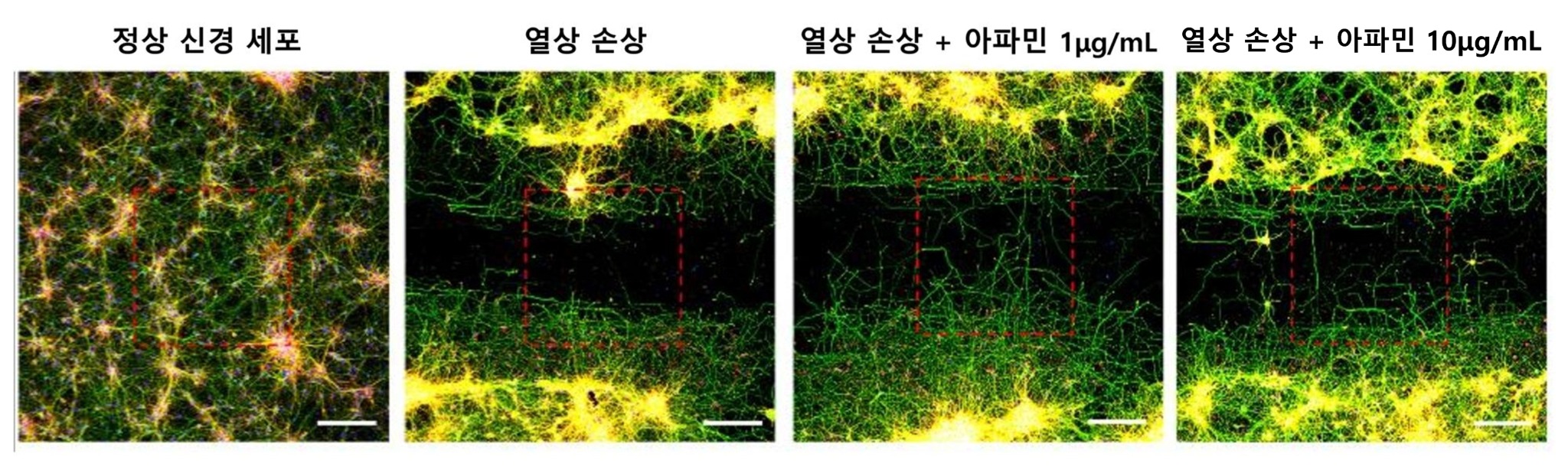 [사진설명] 고배율 현미경 관찰 상 손상을 가한 신경세포와 비교해 아파민을 처리한 신경세포에서는 아파민 농도가 높을수록 축삭돌기의 재생량과 길이가 증가했다 (1).jpg