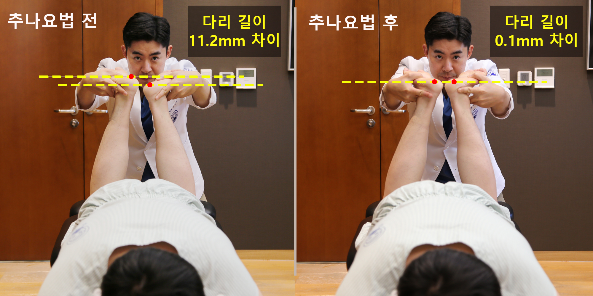 [사진설명] 환자가 직접 추나요법의 효과를 확인할 수 있는 추나요법 전후 비교장치의 화면.jpg