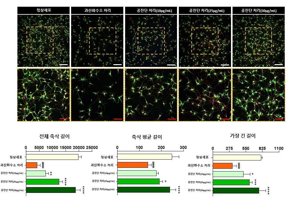 [사진설명] 공진단으로 처리된 신경세포 비율이 농도에 비례해 증가했으며(위) 축삭 길이도 공진단 농도의존적으로 성장이 일어나며 늘어났다.jpg