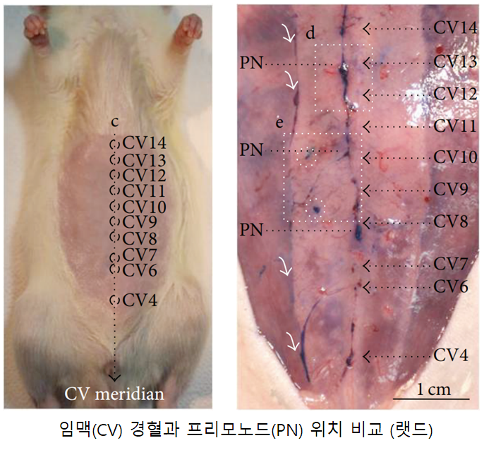 류판동 교수(경락경혈).png