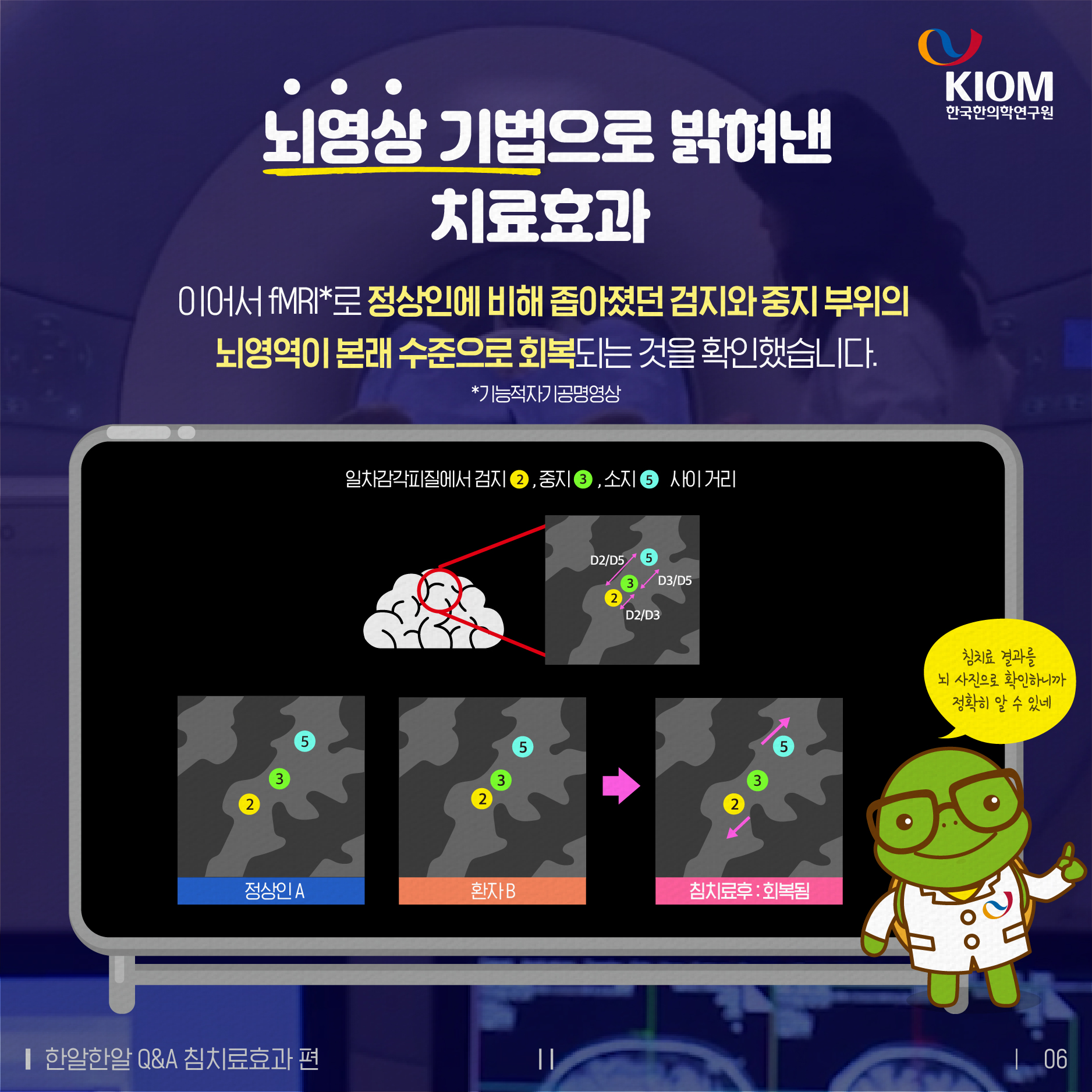 한알한알 Q&amp;A_침치료효과-2차-06.jpg