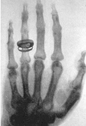 의료기기 (1).jpg