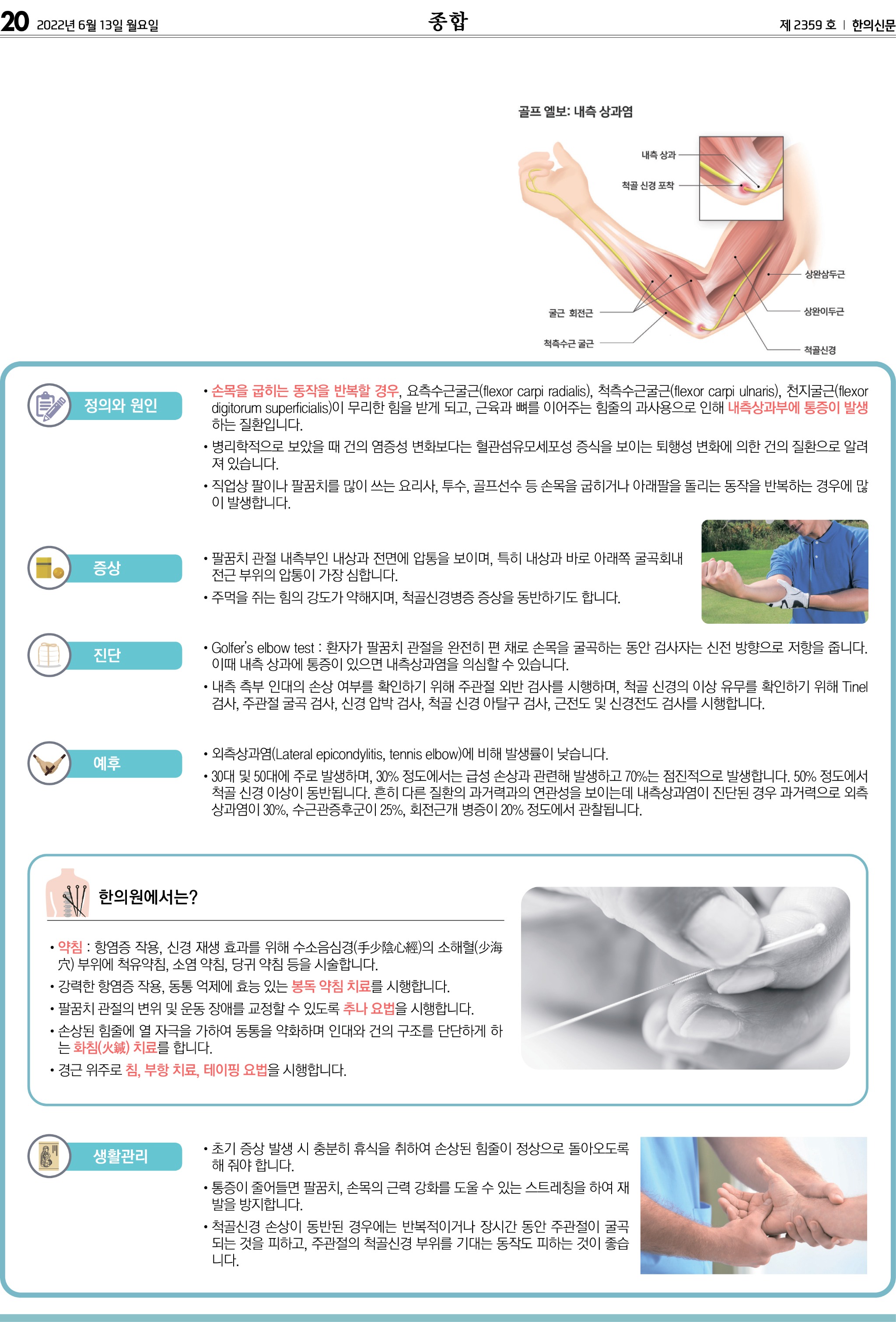 내측상과염 파일 .jpg