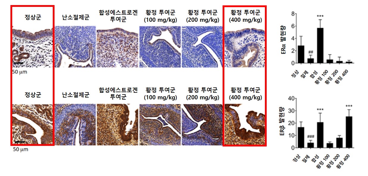 [사진설명] 황정 투여군의 경우 자궁내막에서 ERα는 억제하고 ERβ의 발현만 증가시켜 정상군과 근접한 치료 효과를 보이는 동시에 자궁내막 과형성 억제 효과를 보였다..jpg