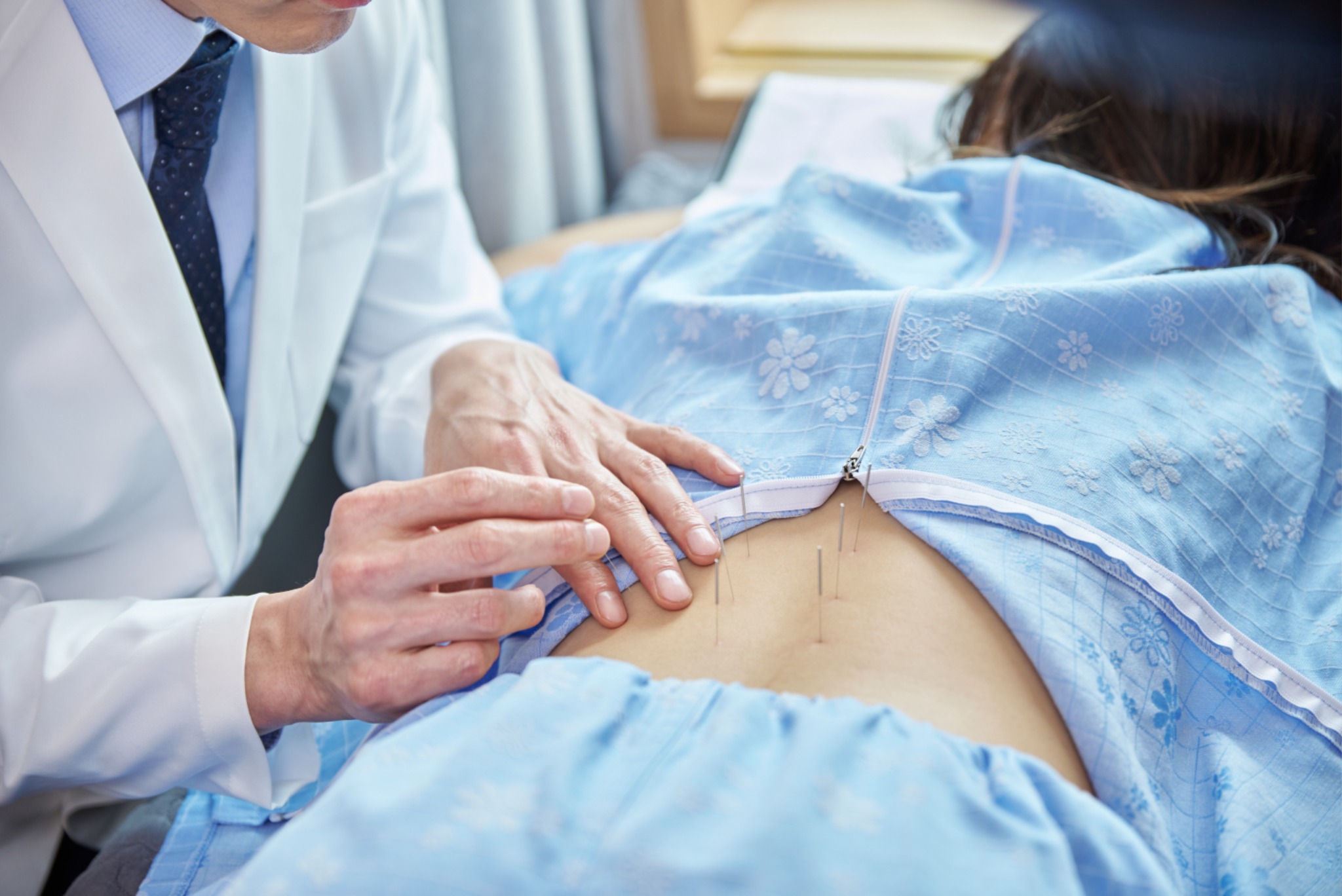 양의사 불법침시술.jpg