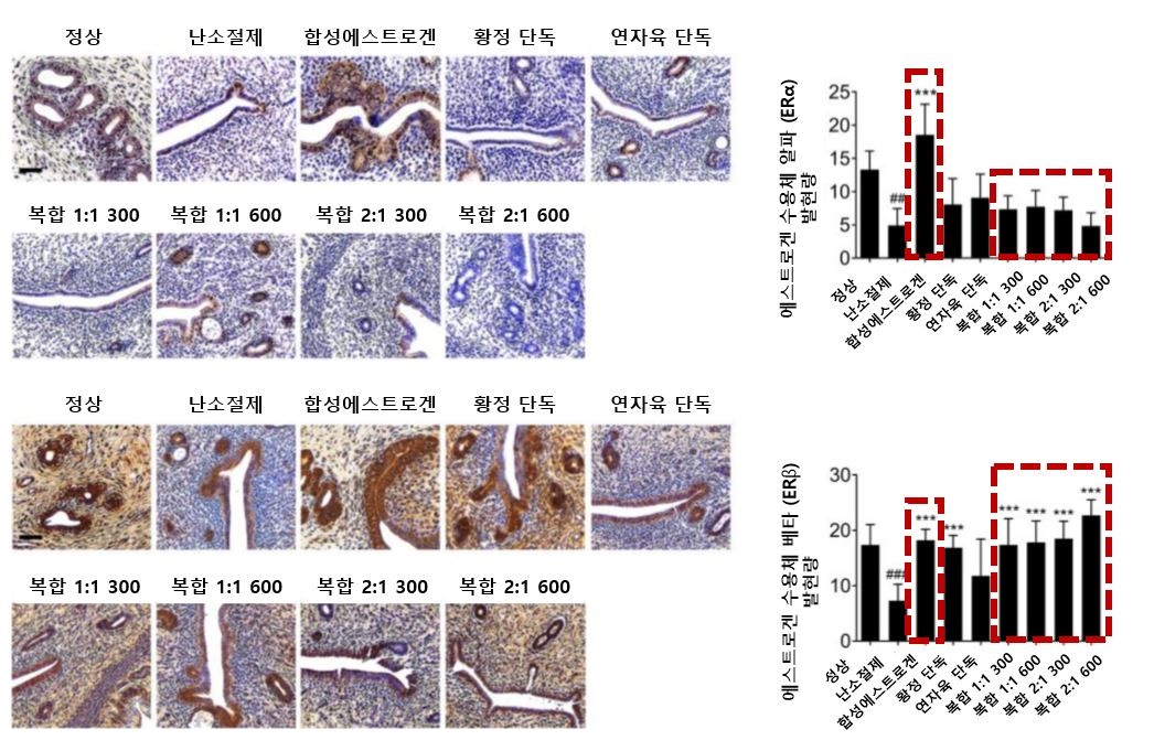 [사진설명] [사진설명] 황정∙연자육 복합 투여군은 대조군들에 비해 ERα 발현을 억제하고 ERβ 발현을 촉진하는 것으로 나타났다.JPG