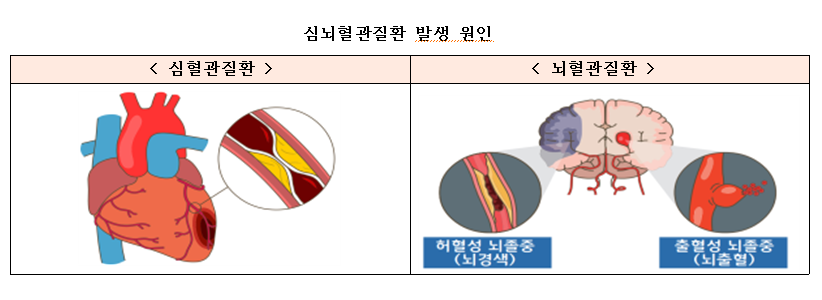 심뇌혈관질환2.png