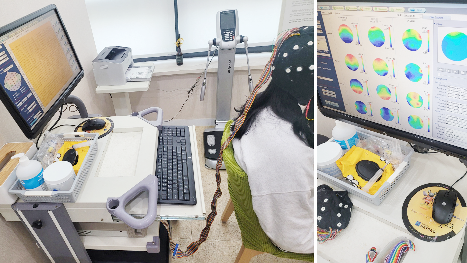 손성훈 한의사(뇌파계).png