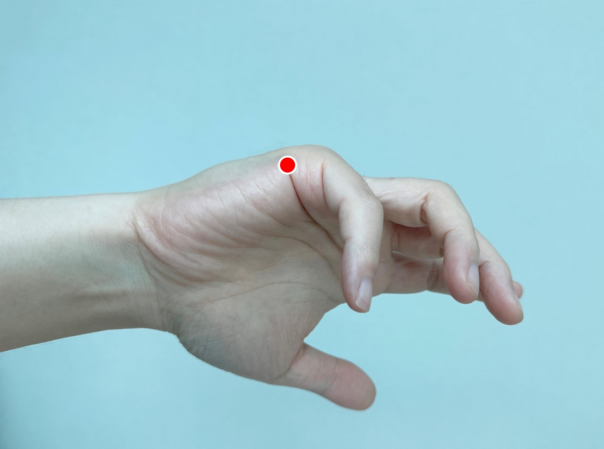 [사진설명] 후계혈.jpg