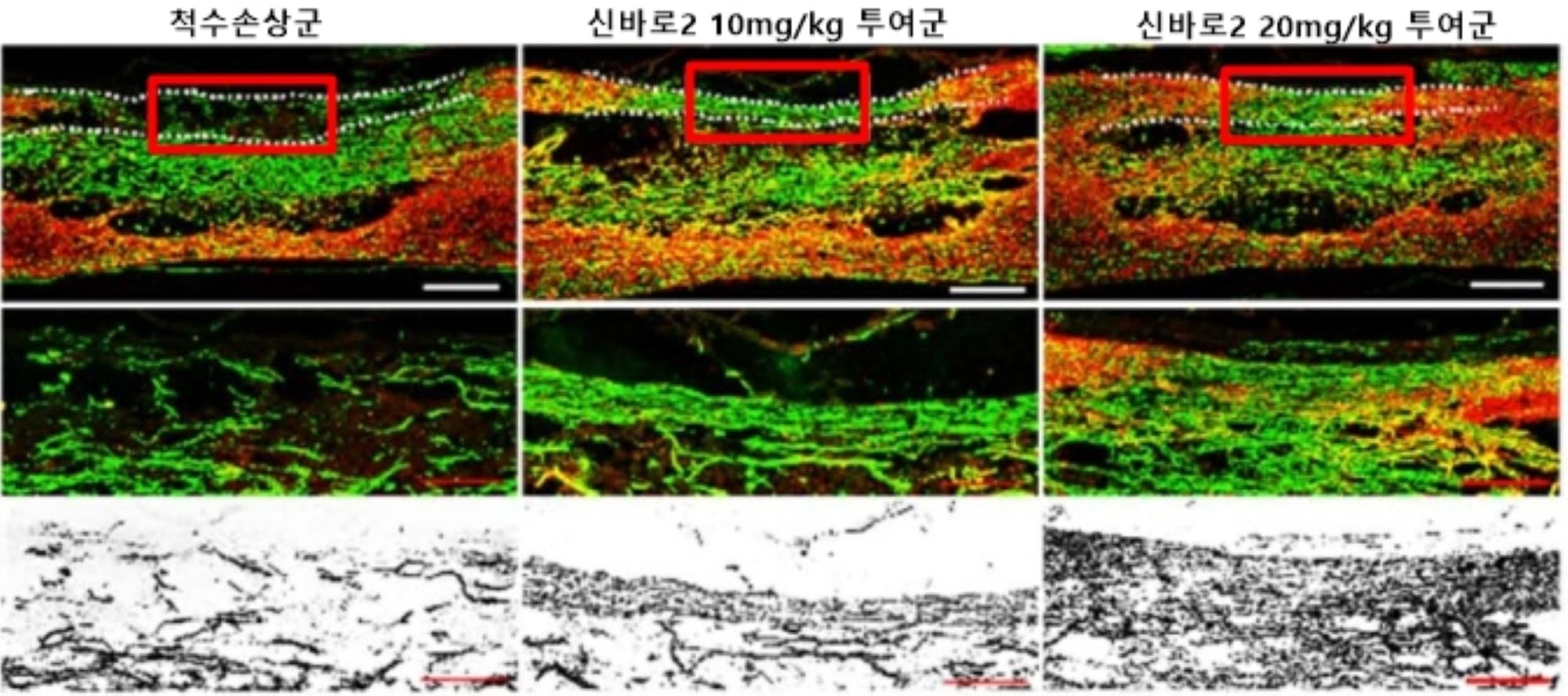 [사진설명] 붉은색으로 표시된 척수손상 부위에서 신바로2 투여군의 세포 축삭 성장을 확인할 수 있다.jpg