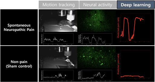 김선광_ 뇌신경 활동의 딥러닝 알고리즘 적용을 통한 실시간 통증 측정 예.png