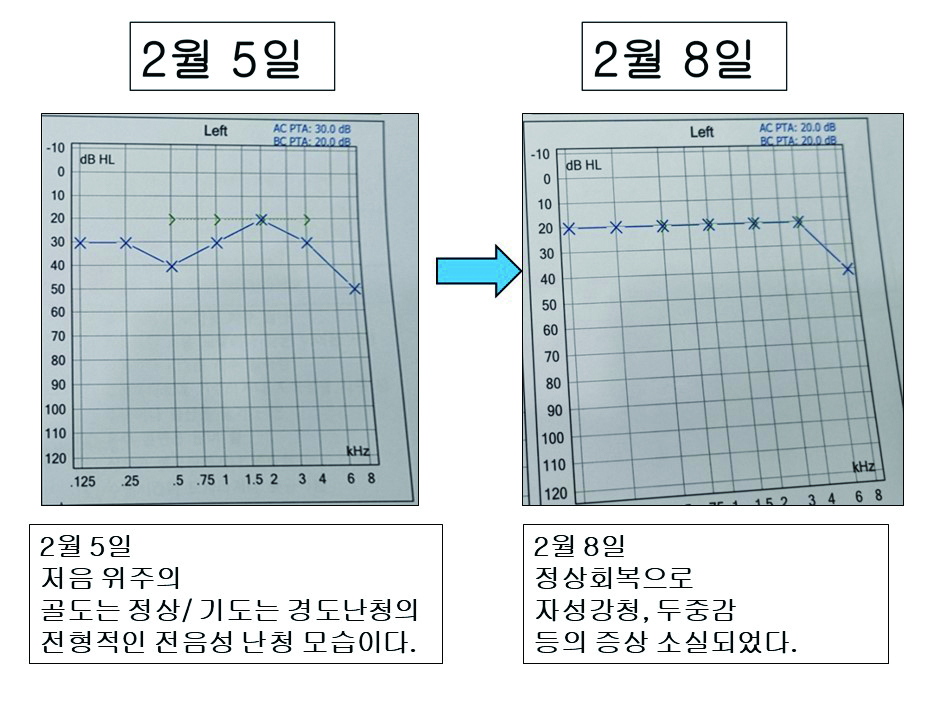 정현아_07.JPG