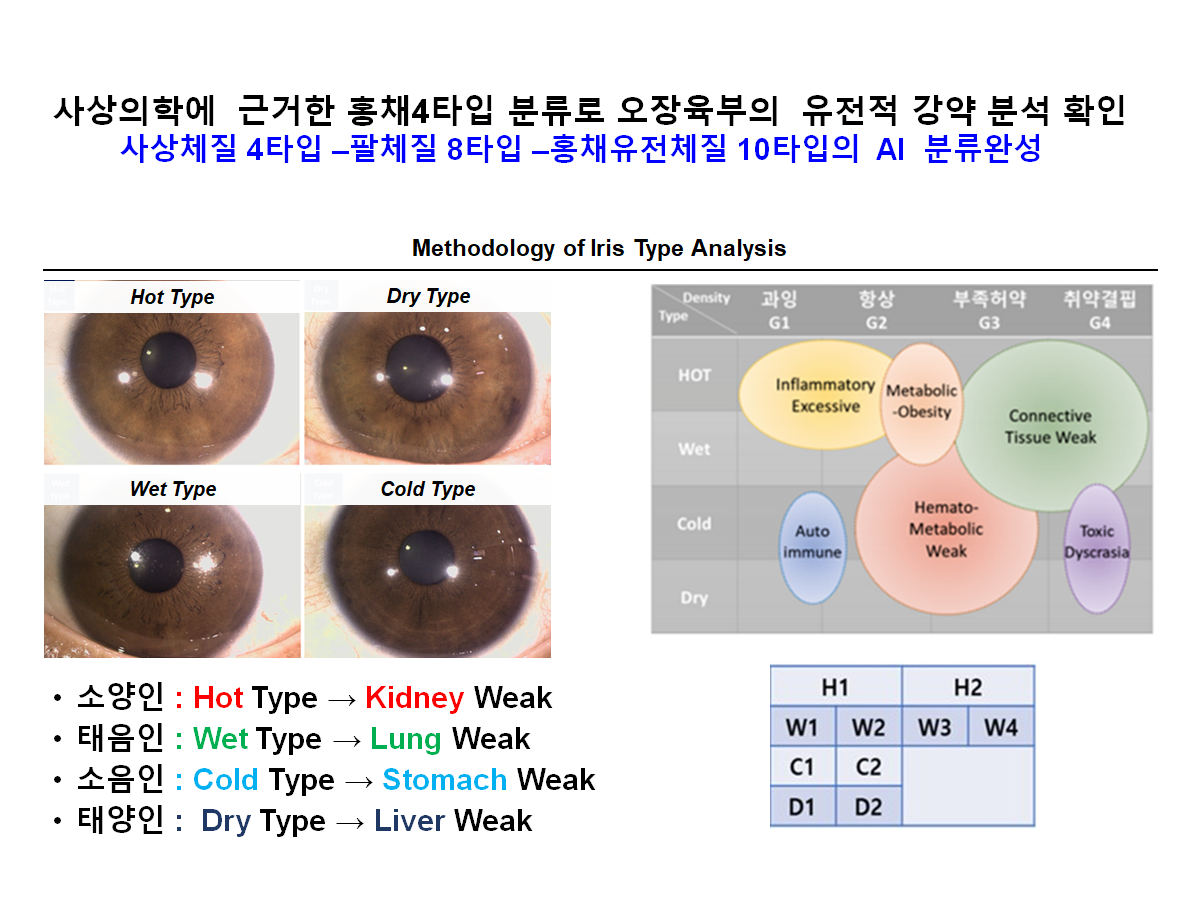 홍채6.png