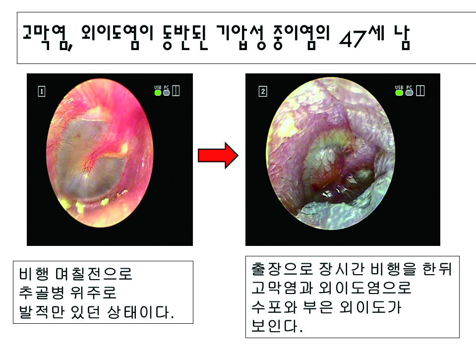 정현아 04.JPG