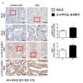 폐암의 항암제 내성 극복위한 새로운 가능성 제시