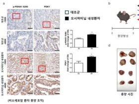 폐암의 항암제 내성 극복위한 새로운 가능성 제시