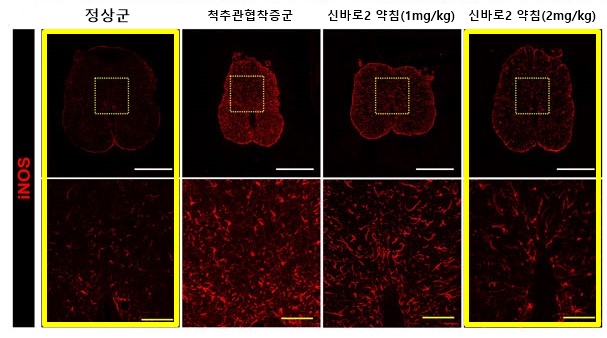 [사진설명] 신바로2 약침 농도에 따라 붉은색으로 표시된 염증 매개 인자(iNOS)의 발현이 줄어드는 모습.jpg