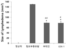 경과원 바이오센터, 난치성 질환 ‘림프부종’ 치료물질 개발