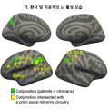 한의학연, 하버드 의대와 침의 과학적 근거 마련 ‘박차’