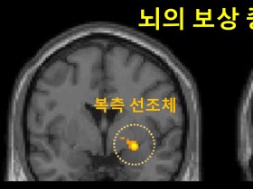 진통제 가격으로 인한 플라시보 효과 기전 ‘규명’