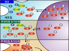 퇴행성 뇌질환 초기 치료 가능성 모델 제시