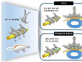 척추관협착증 치료 위한 뇌척수액 내 산화스트레스 변화 규명