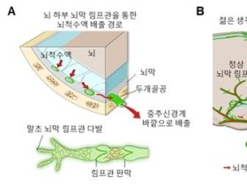 IBS 연구진, 치매 유발하는 뇌 속 노폐물 배출 경로 찾았다!