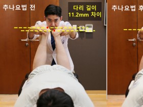 자생한방병원, ‘추나 전후 비교장치’ 특허 취득