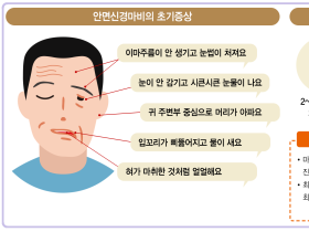 생소한 람세이헌트 증후군, 안면마비 원인 ‘3위’