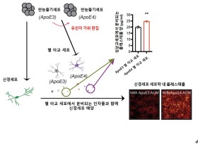 사람 만능줄기세포 이용해 알츠하이머 치매 발병 과정 규명