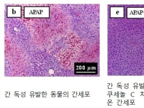 ‘고삼’의 간 보호 효과 확인