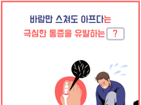 바람만 스쳐도 아프다는 극심한 통증을 유발하는 통풍