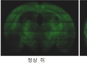 홍잠의 알츠하이머 치매 예방 효과 확인