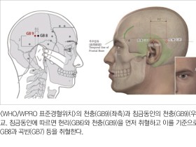 침금동인으로 복원한 내의원 표준경혈4