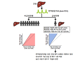 면역항암치료 후 간암 급성진행 현상 규명