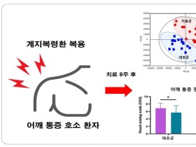 계지복령환의 통증 개선 효능 ‘과학적 입증’