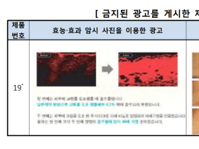 미세침 이용 피부자극기 유사품 관리 '사각지대'