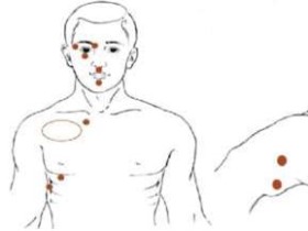 한의협, '감정자유기법' 신의료기술 등재 환영