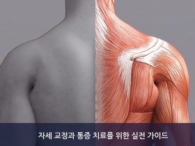 [신간]근육 불균형의 평가와 치료 전략