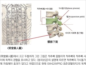 침금동인으로 복원한 내의원 표준경혈5