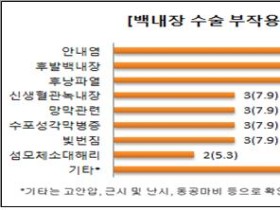 쉽게 결정하는 ‘백내장 수술’, 부작용 발생 주의해야