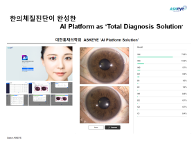 대한홍채의학회, 홍채유전체질 분류 신기술 개발