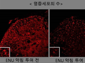 ENU약학조성물, 신경병증성 통증 개선에 효과